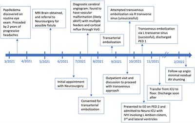 Case report: Transvenous coil embolization of a high-grade Galenic dural arteriovenous fistula